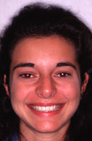 lr2-1.jpg (6340 bytes)